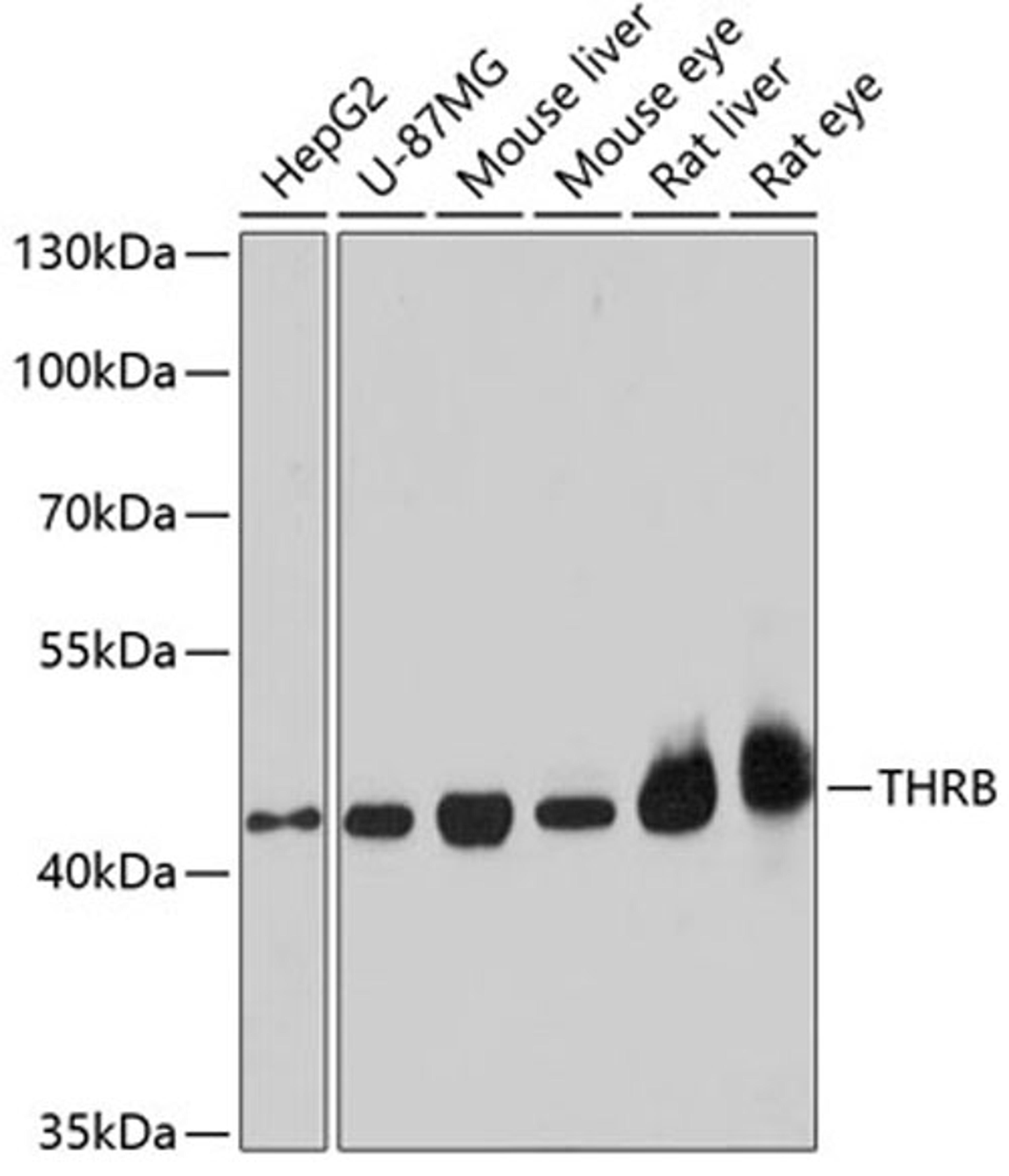 Western blot - THRB antibody (A1582)