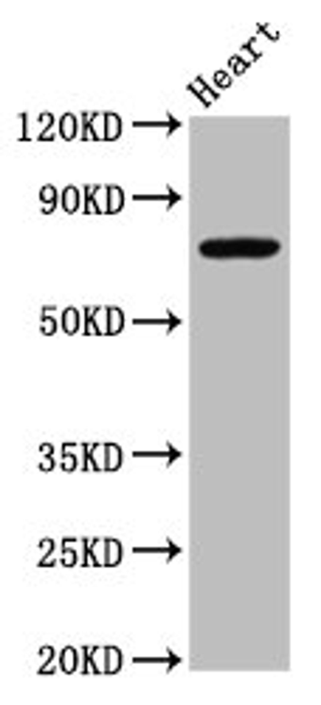 Western Blot. Positive WB detected in: Rat heart tissue. All lanes: NLRP10 antibody at 4.9ug/ml. Secondary. Goat polyclonal to rabbit IgG at 1/50000 dilution. Predicted band size: 76 kDa. Observed band size: 76 kDa. 