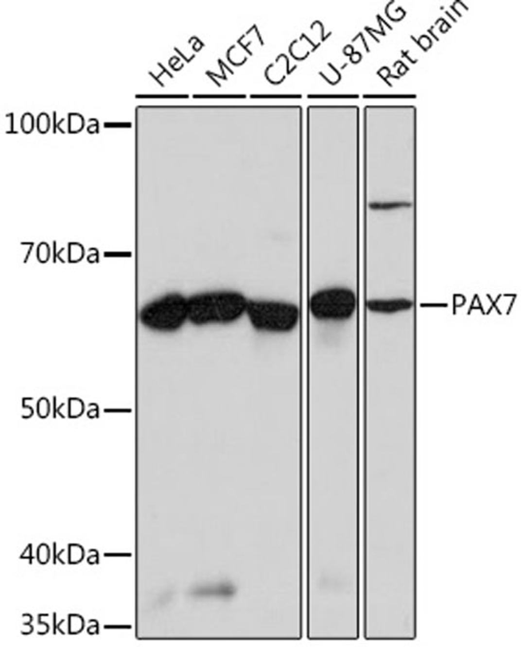 Western blot - PAX7 Rabbit mAb (A4134)