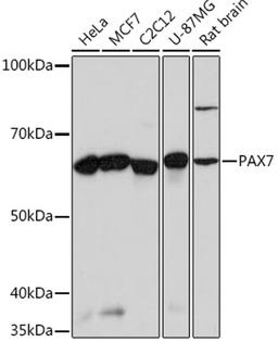 Western blot - PAX7 Rabbit mAb (A4134)