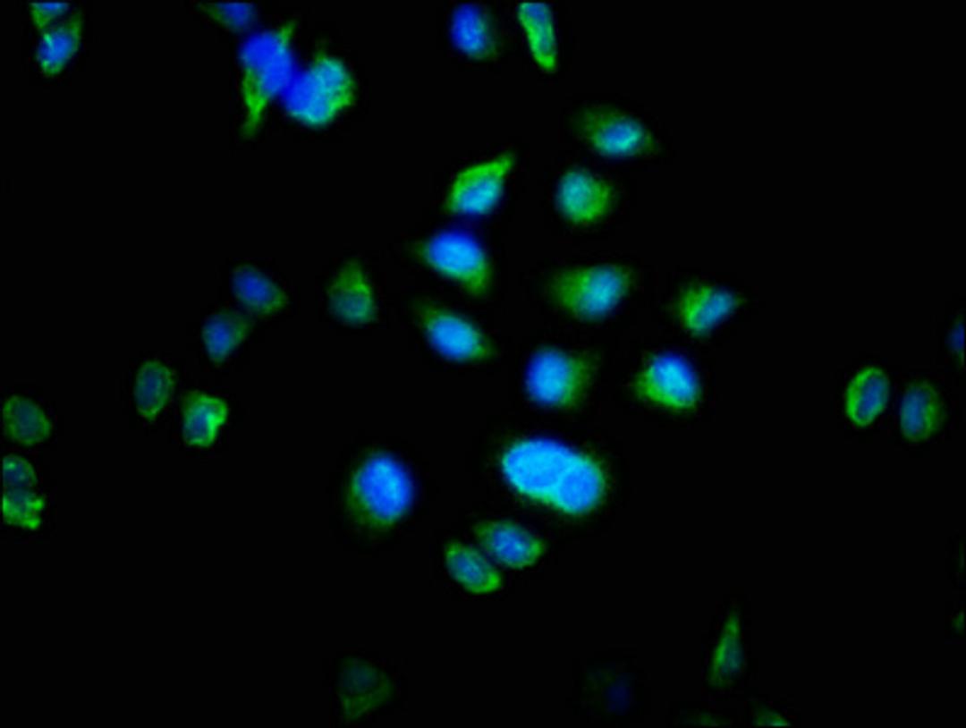 Immunofluorescence staining of Hela cells with CSB-PA015197LA01HU at 1:100, counter-stained with DAPI. The cells were fixed in 4% formaldehyde, permeabilized using 0.2% Triton X-100 and blocked in 10% normal Goat Serum. The cells were then incubated with the antibody overnight at 4°C. The secondary antibody was Alexa Fluor 488-congugated AffiniPure Goat Anti-Rabbit IgG(H+L).