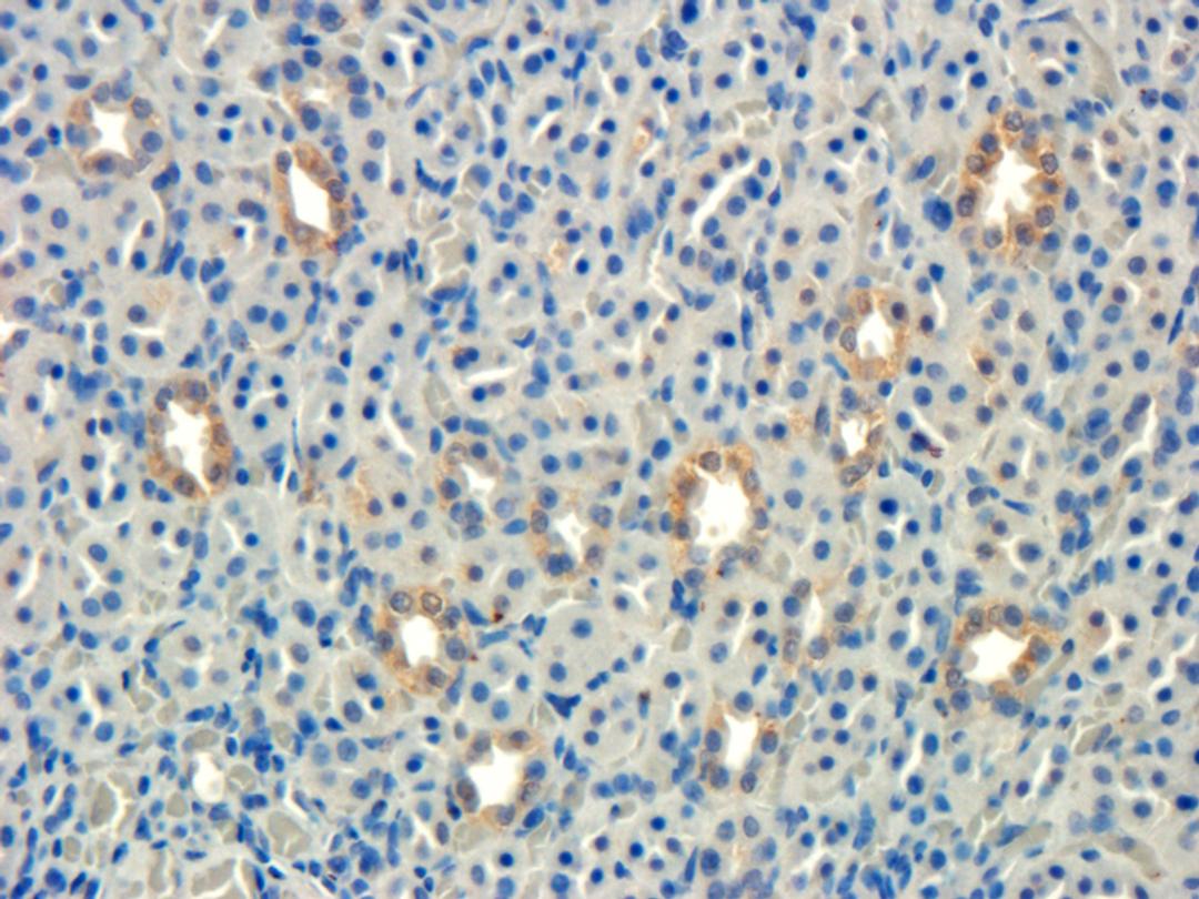 Immunohistochemical staining of rat kidney tissue using Integrin beta 7 antibody (dilution of primary antibody - 1:100)