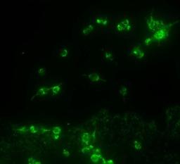 Immunocytochemistry/Immunofluorescence: TRPA1 Antibody [NB110-40763] - IF analysis of TRPA1 in HEK 293 cells (Flp In Trex system) cells.