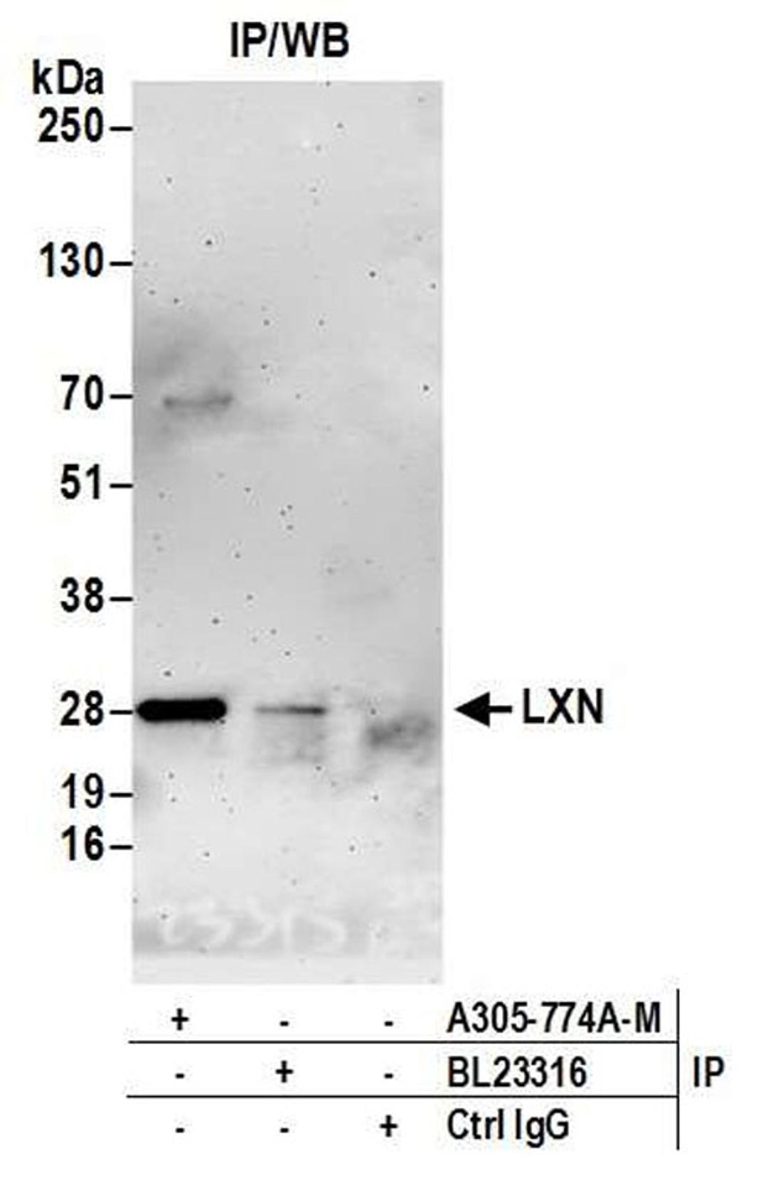 Detection of human LXN by WB of IP.