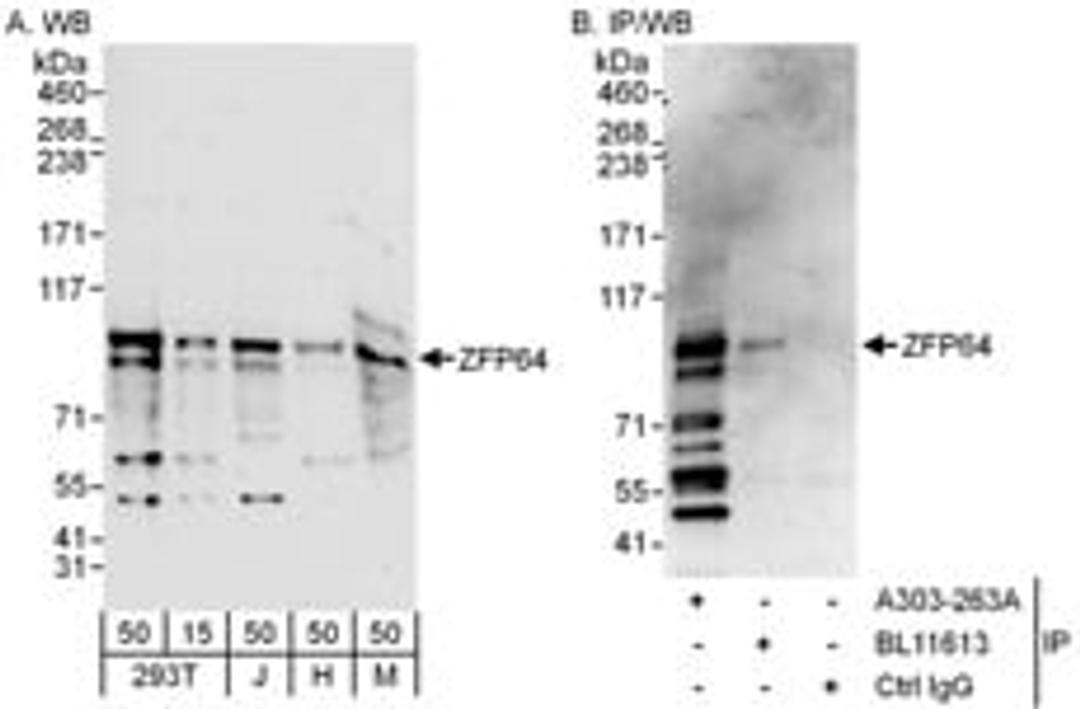 Detection of human and mouse ZFP64 by western blot (h and m) and immunoprecipitation (h).