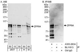 Detection of human and mouse ZFP64 by western blot (h and m) and immunoprecipitation (h).