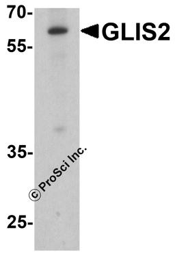 Western blot analysis of GLIS2 in K562 cell lysate with GLIS2 antibody at 1 μg/ml.