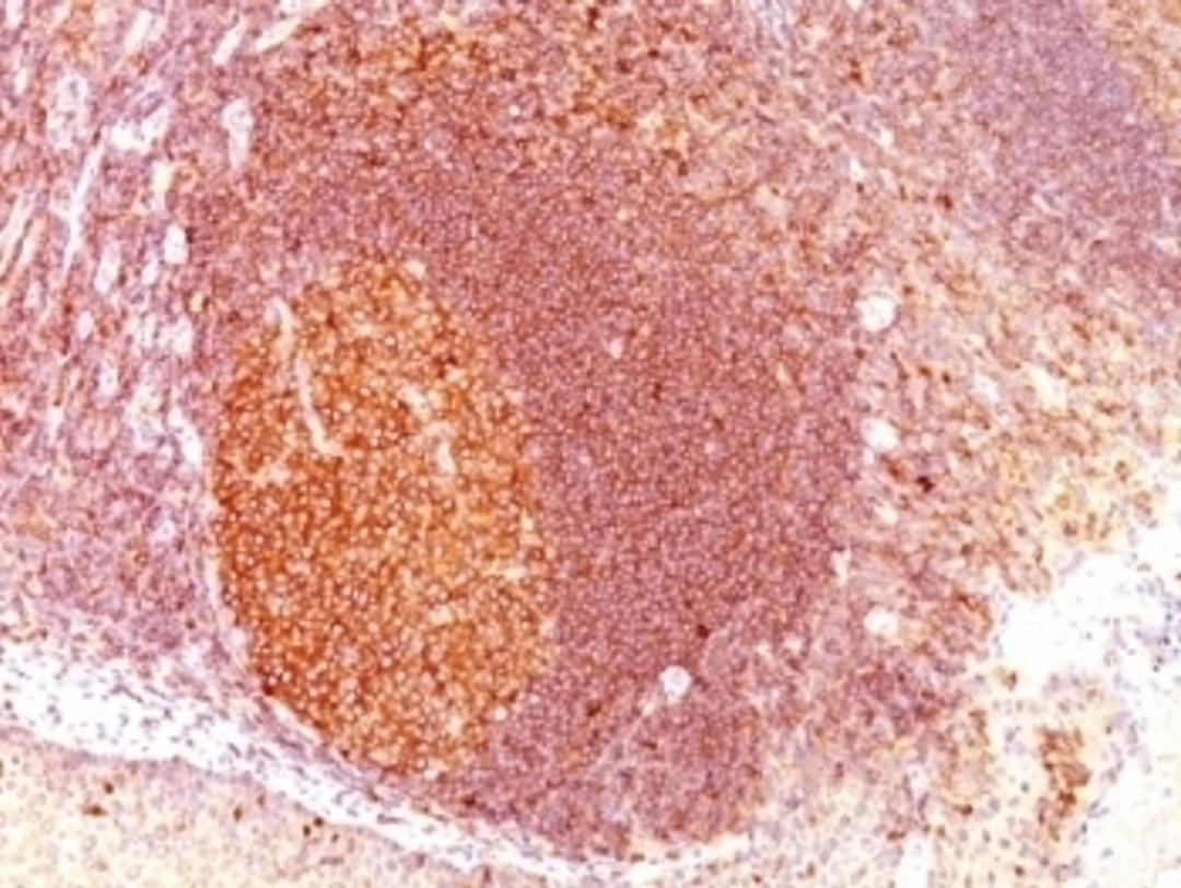 Formalin-fixed, paraffin-embedded human tonsil stained with MALT1 antibody (SPM578)