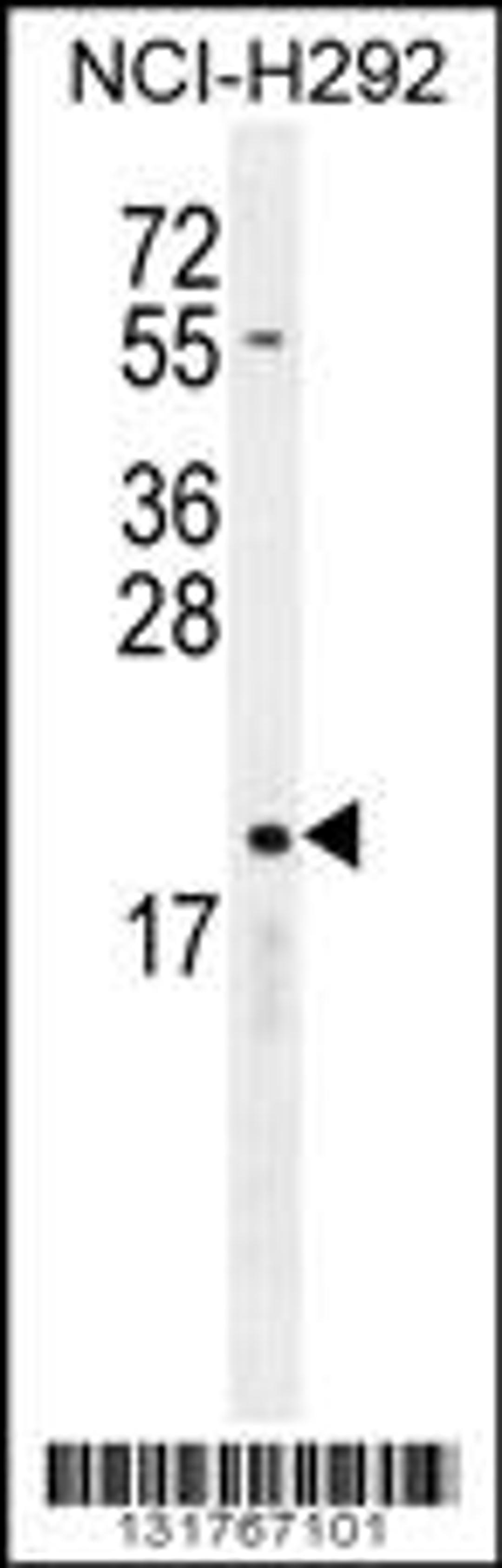 Western blot analysis in NCI-H292 cell line lysates (35ug/lane).