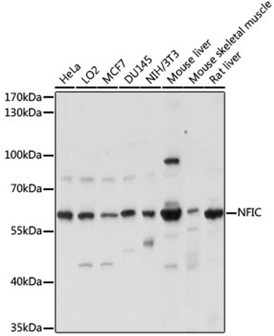 Western blot - NFIC antibody (A15074)