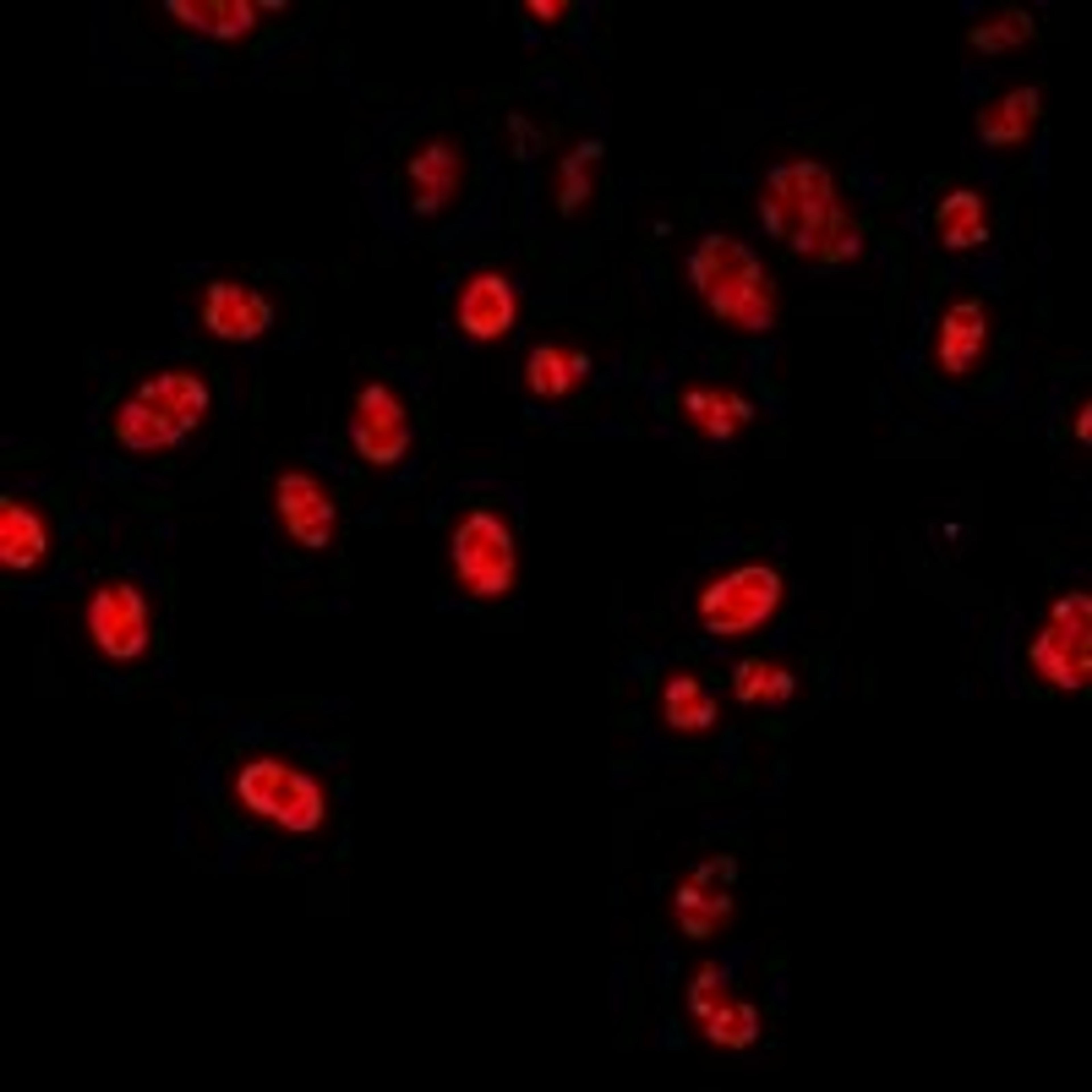 Immunofluorescent analysis of A549 cells using HLX antibody