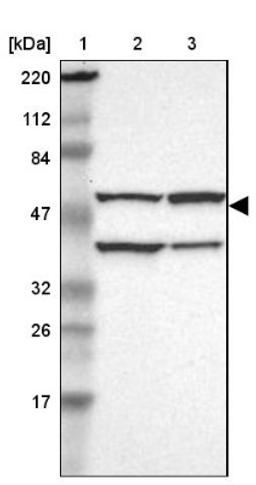 Western Blot: CECR5 Antibody [NBP1-86136] - Lane 1: Marker [kDa] 220, 112, 84, 47, 32, 26, 17<br/>Lane 2: Human cell line RT-4<br/>Lane 3: Human cell line U-251MG sp