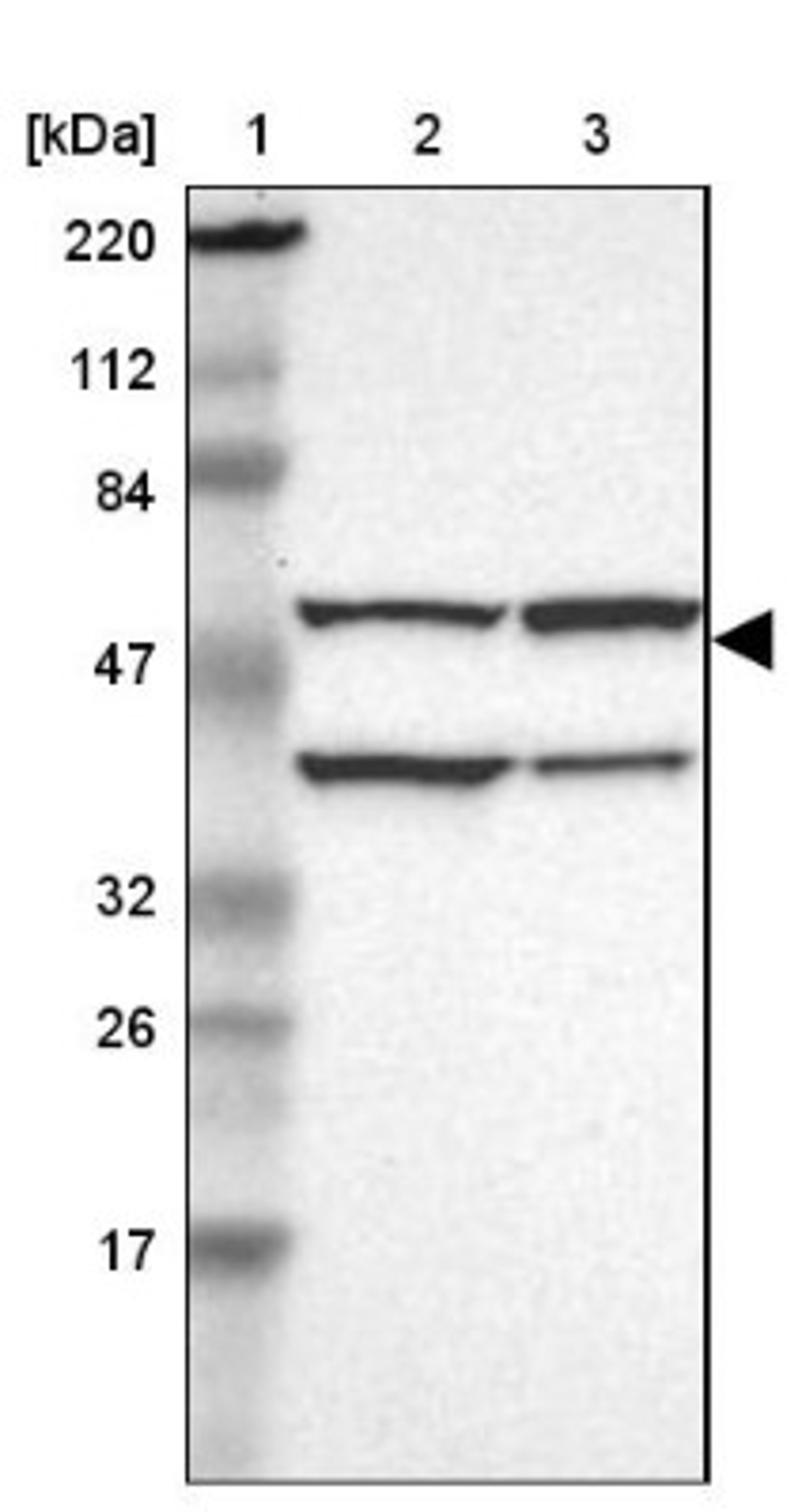 Western Blot: CECR5 Antibody [NBP1-86136] - Lane 1: Marker [kDa] 220, 112, 84, 47, 32, 26, 17<br/>Lane 2: Human cell line RT-4<br/>Lane 3: Human cell line U-251MG sp