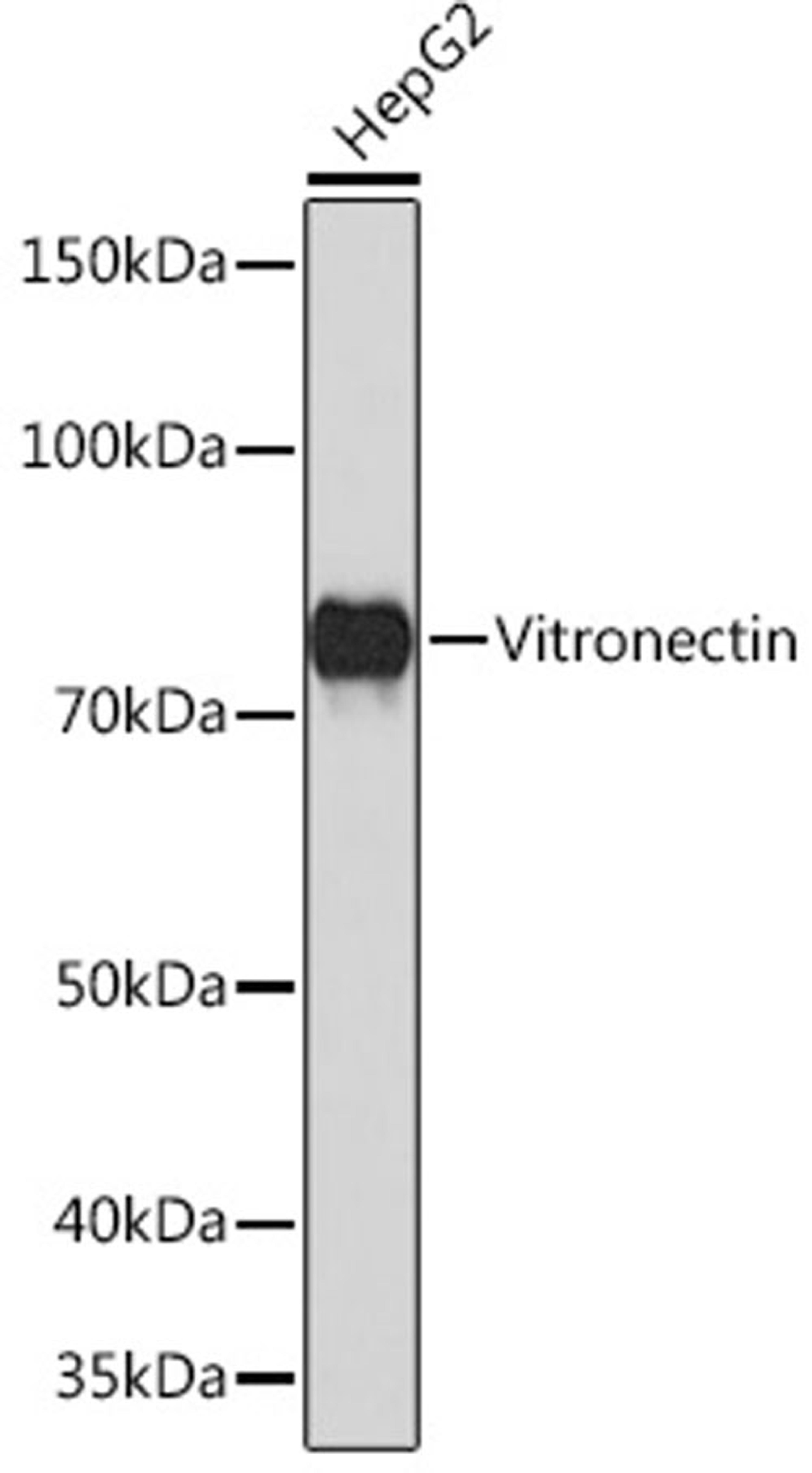 Western blot - Vitronectin  Rabbit mAb (A4883)