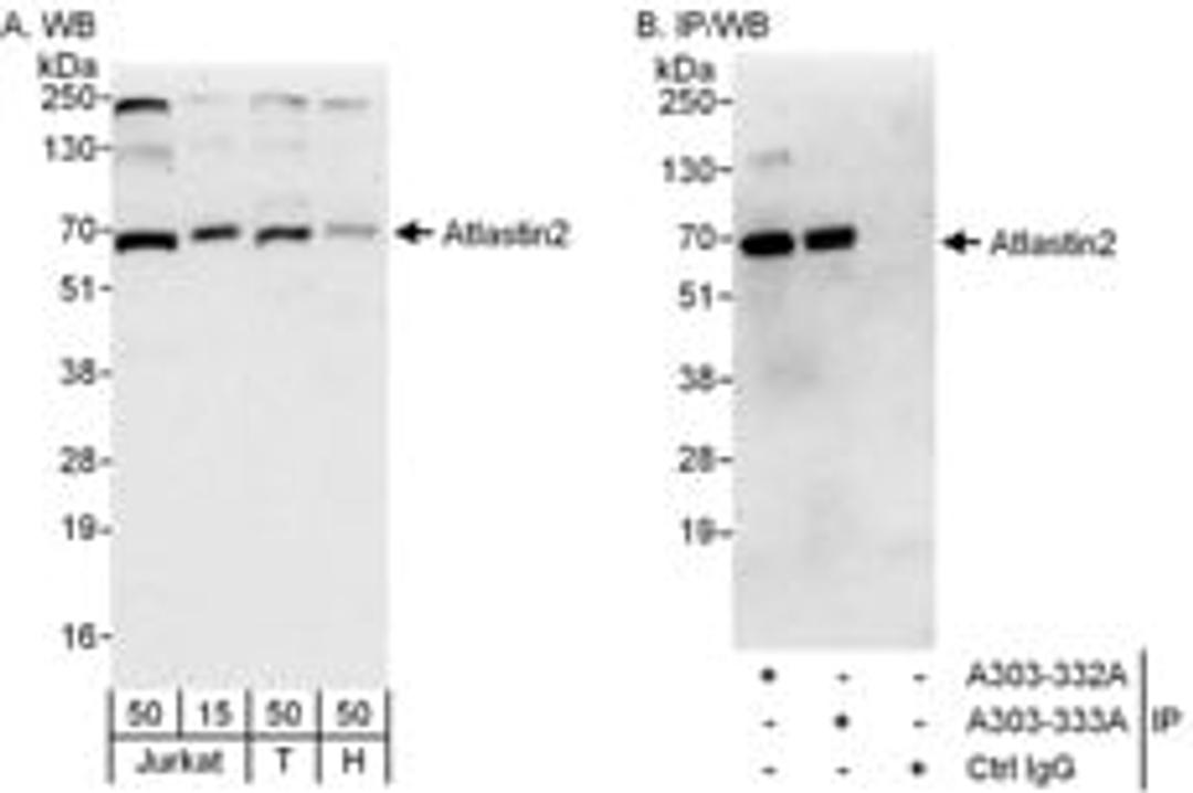 Detection of human Atlastin2 by western blot and immunoprecipitation.