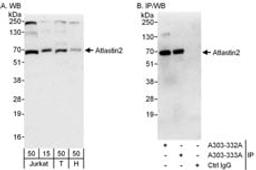 Detection of human Atlastin2 by western blot and immunoprecipitation.