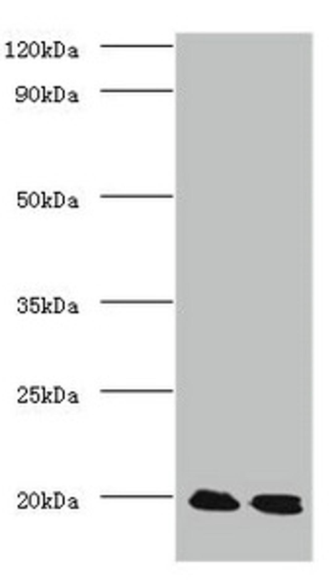 Western blot. All lanes: Protein DJ-1 antibody at 2ug/ml. Lane 1: EC109 whole cell lysate. Lane 2: 293T whole cell lysate. Secondary. Goat polyclonal to Rabbit IgG at 1/15000 dilution. Predicted band size: 20 kDa. Observed band size: 20 kDa. 