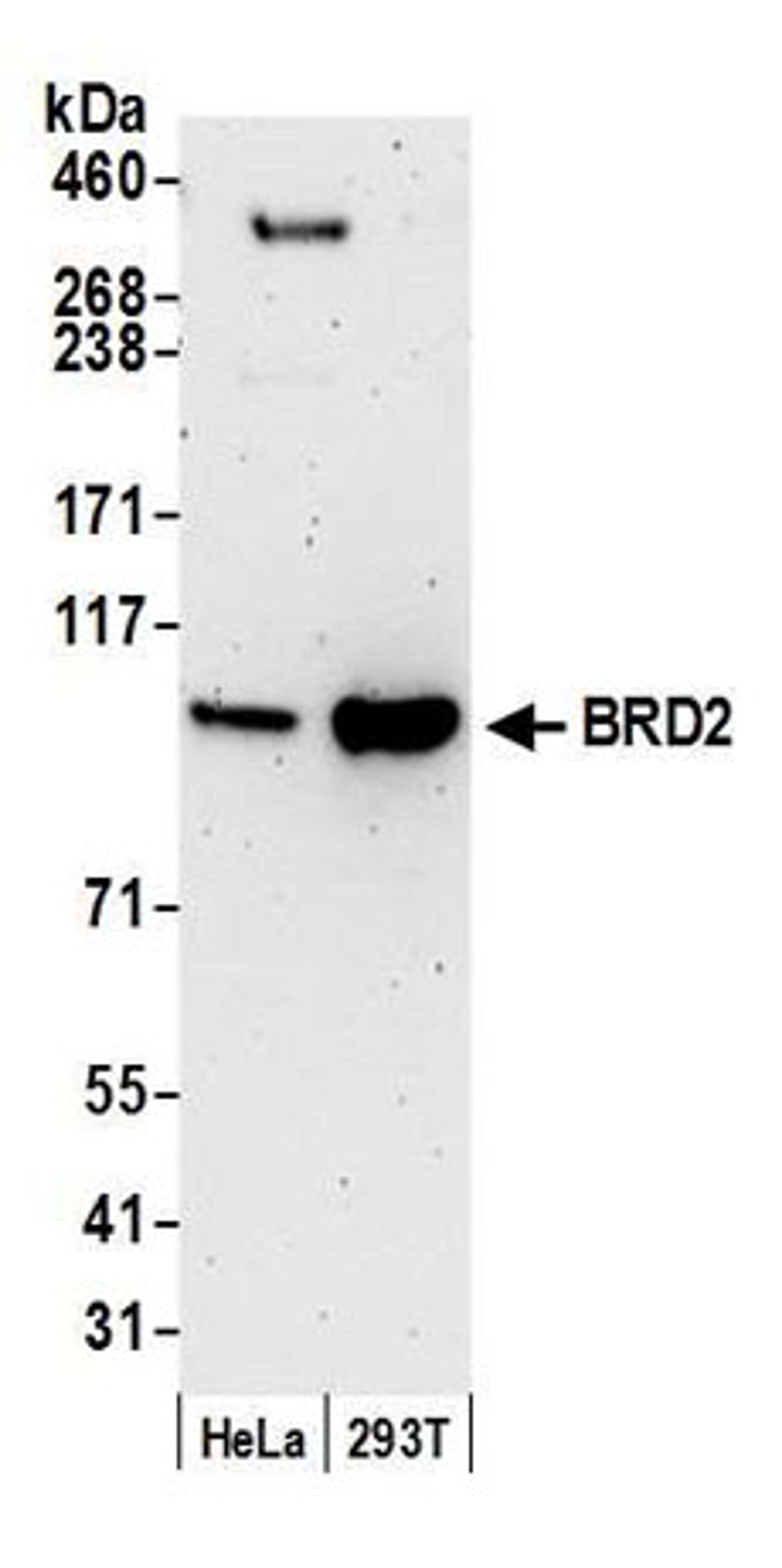 Detection of human BRD2 by western blot.