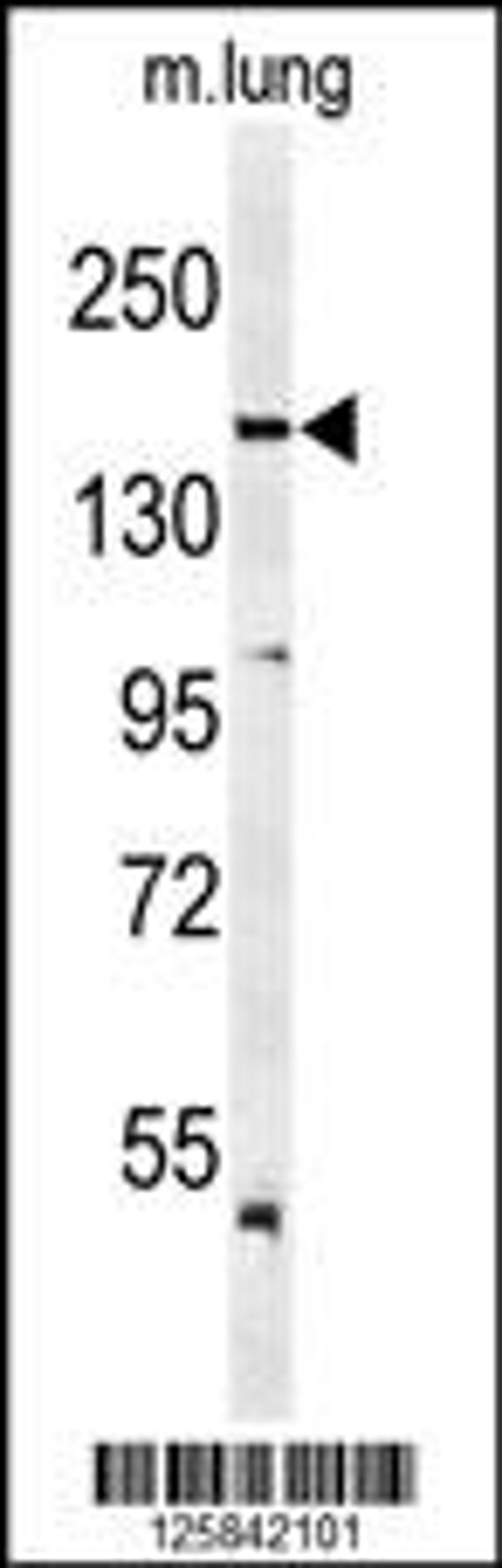 Western blot analysis of KDR (Y1175) Antibody in mouse lung tissue lysates (35ug/lane)