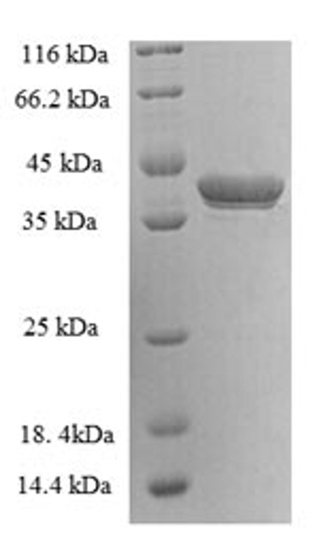 (Tris-Glycine gel) Discontinuous SDS-PAGE (reduced) with 5% enrichment gel and 15% separation gel.