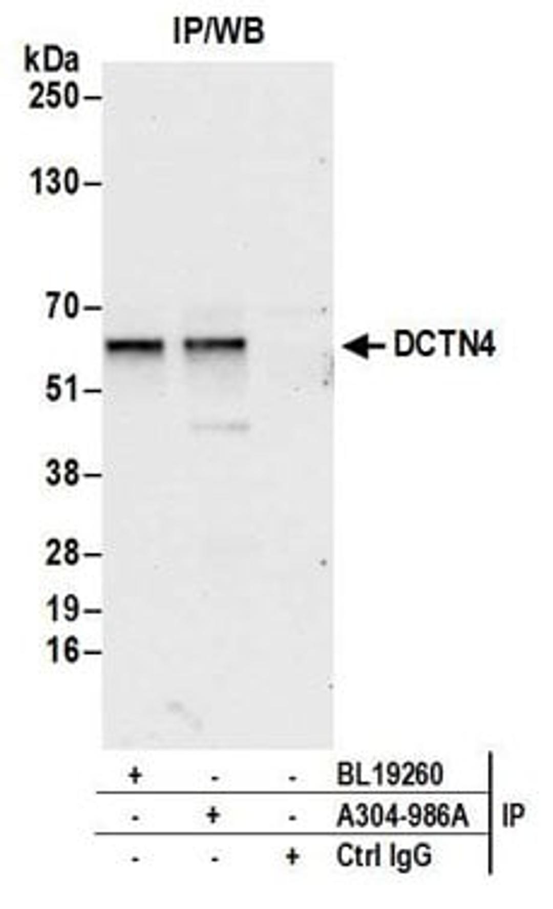 Detection of human DCTN4 by western blot of immunoprecipitates.