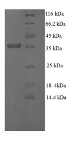 (Tris-Glycine gel) Discontinuous SDS-PAGE (reduced) with 5% enrichment gel and 15% separation gel.