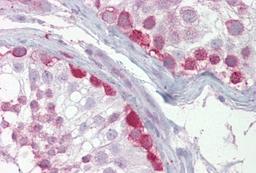 Immunohistochemistry-Paraffin: CRY1 Antibody [NBP1-69080] - Human testis tissue at an antibody concentration of 5ug/ml.