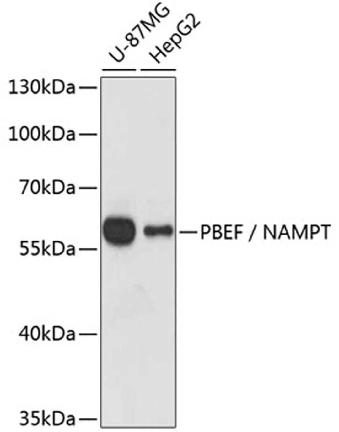 Western blot - PBEF / NAMPT antibody (A0256)