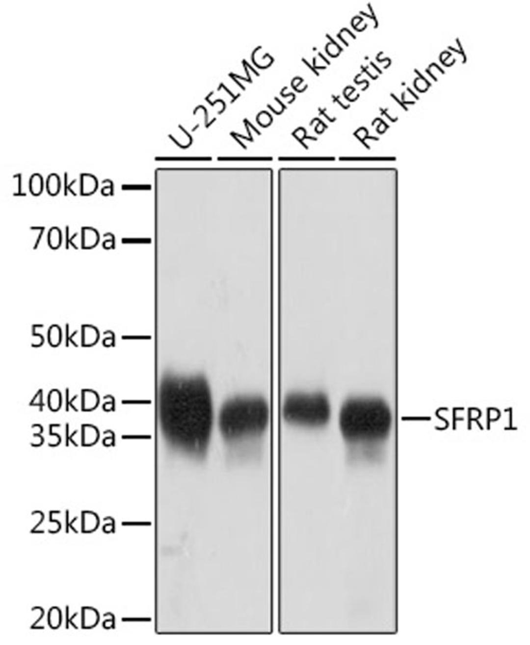 Western blot - SFRP1 Rabbit mAb (A9656)