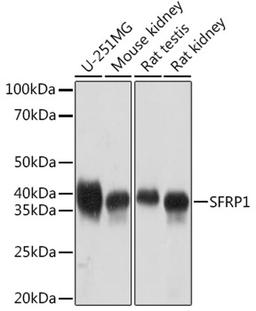 Western blot - SFRP1 Rabbit mAb (A9656)