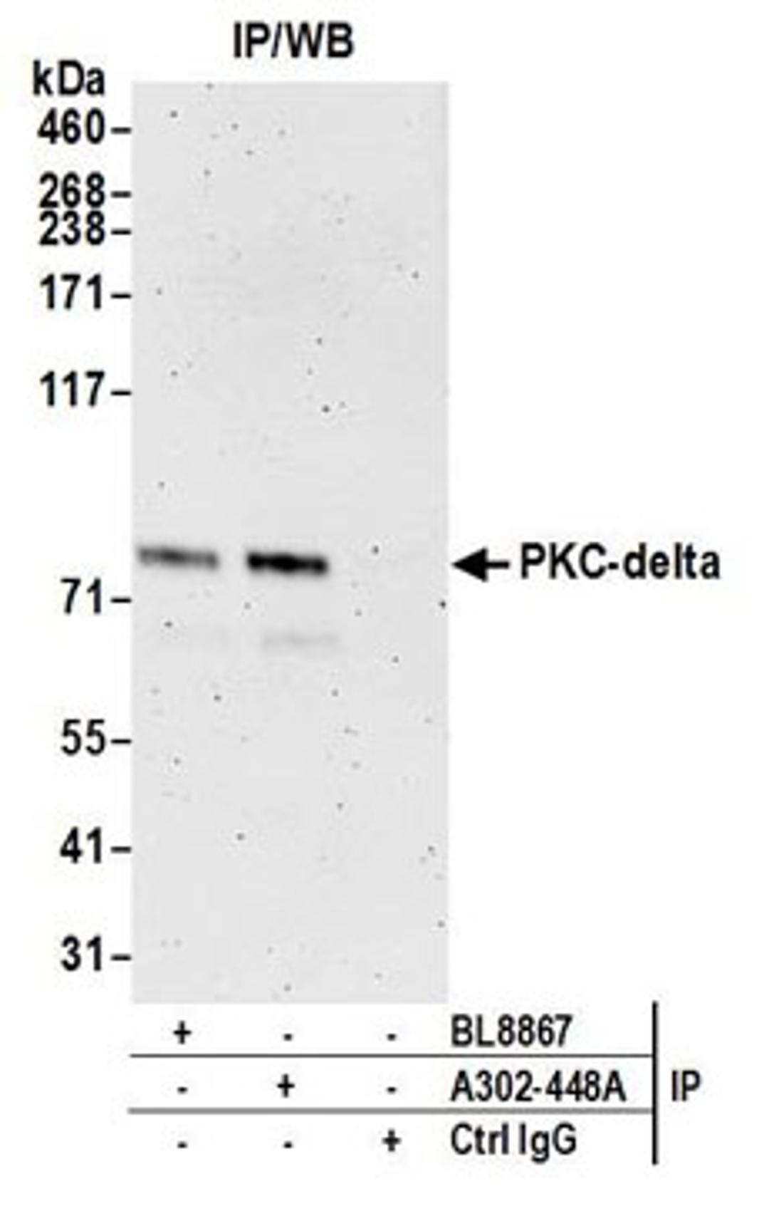 Detection of human PKC-delta by western blot of immunoprecipitates.