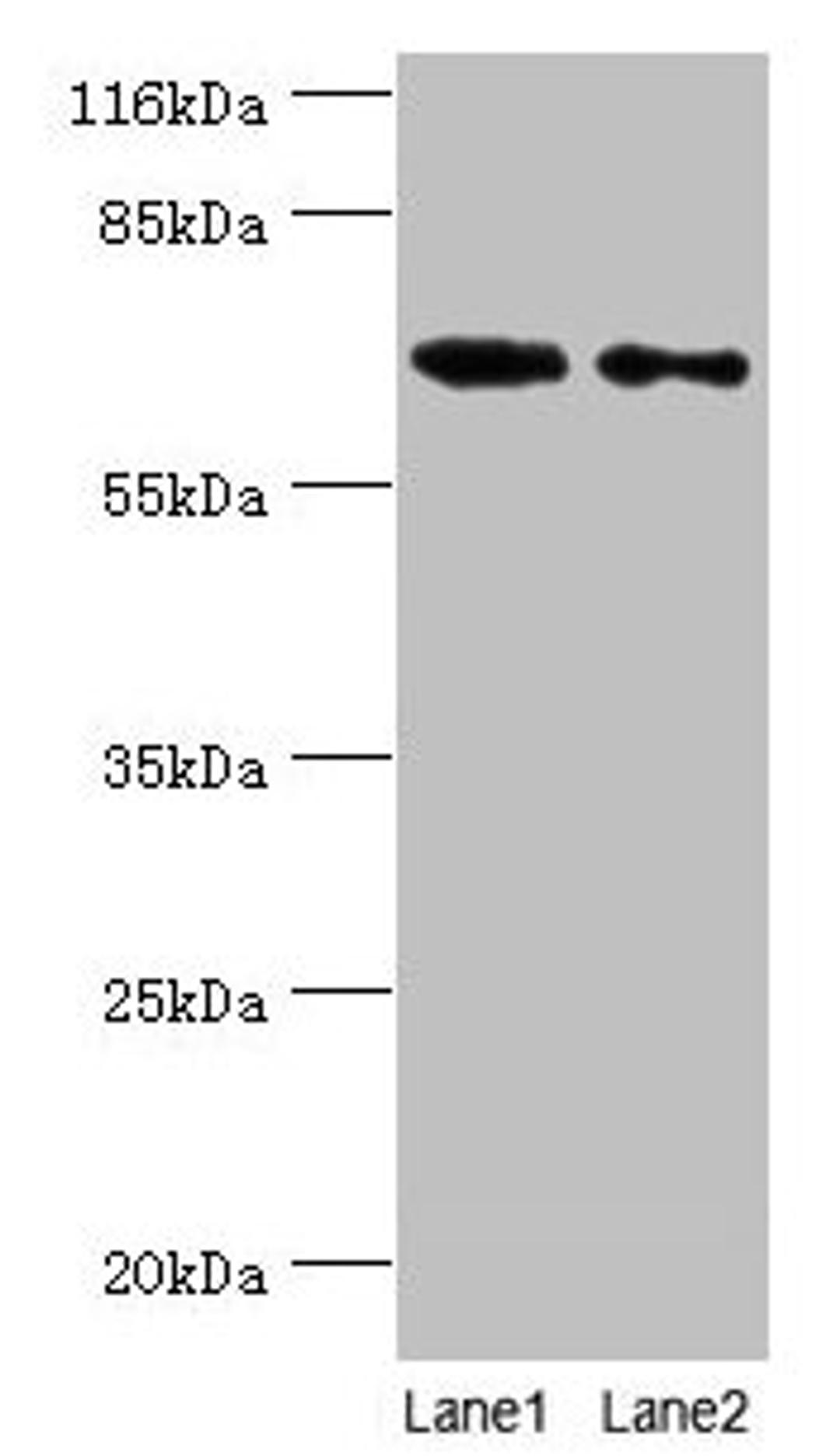 Western blot. All lanes: GALNT14 antibody at 2µg/ml. Lane 1: Rat gonad tissue. Lane 2: Mouse kidney tissue. Secondary. Goat polyclonal to rabbit IgG at 1/10000 dilution. Predicted band size: 65, 61, 62 kDa. Observed band size: 65 kDa