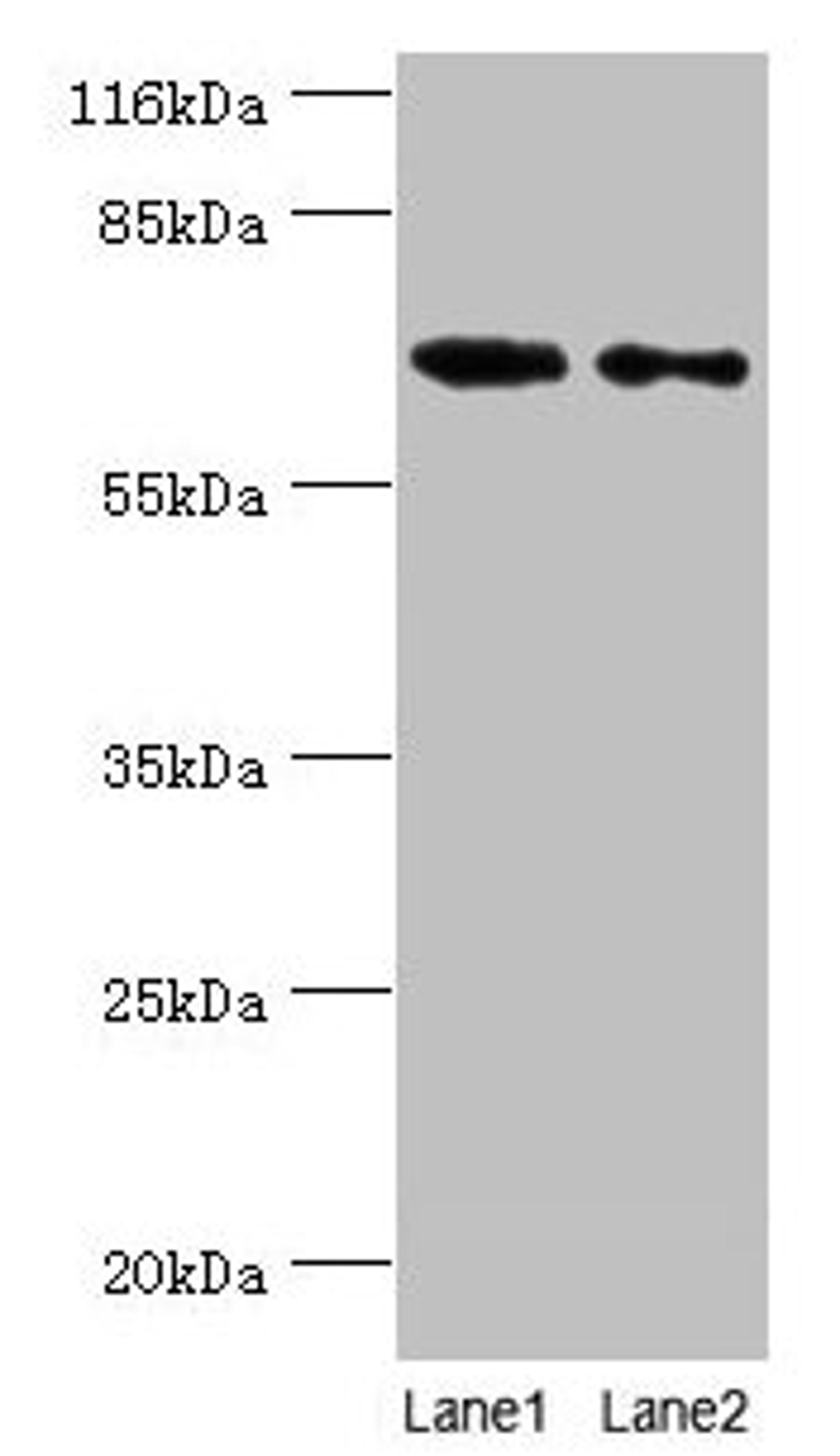 Western blot. All lanes: GALNT14 antibody at 2µg/ml. Lane 1: Rat gonad tissue. Lane 2: Mouse kidney tissue. Secondary. Goat polyclonal to rabbit IgG at 1/10000 dilution. Predicted band size: 65, 61, 62 kDa. Observed band size: 65 kDa