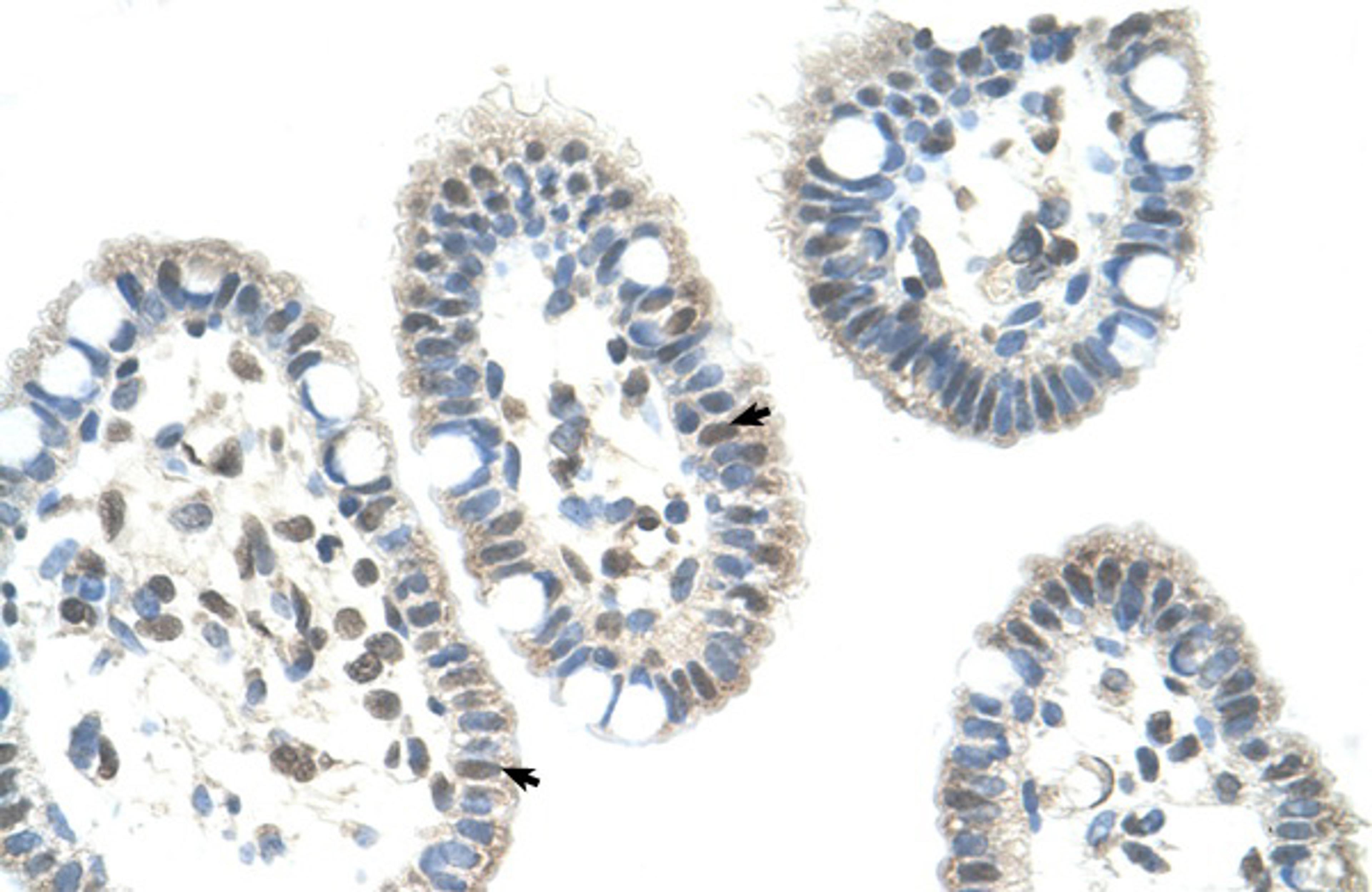 Antibody used in IHC on Human Intestine.