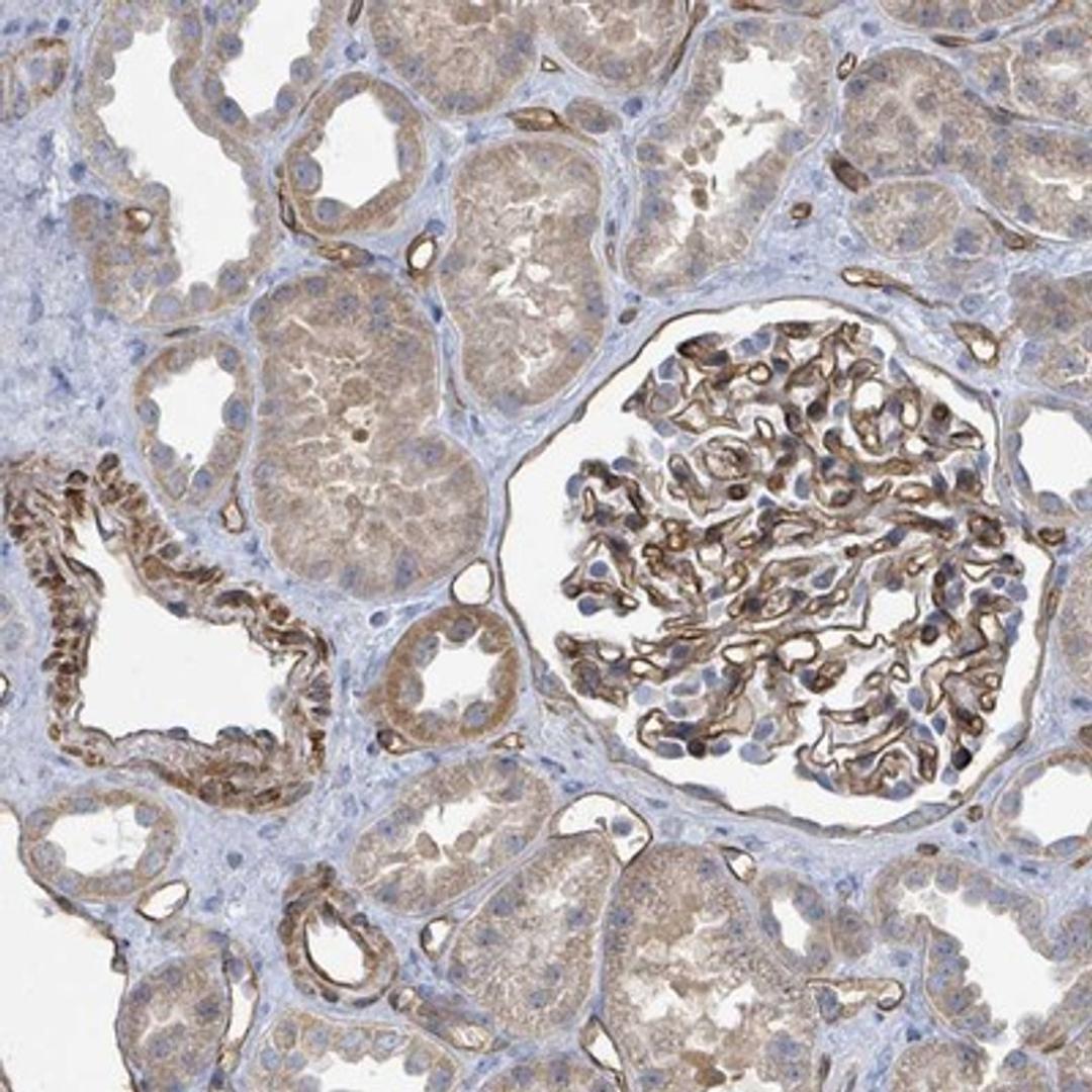 Immunohistochemistry-Paraffin: KANK3 Antibody [NBP2-14138] Staining of human kidney shows moderate cytoplasmic positivity in cells in tubules while cells in glomeruli exhibited strong membranous staining.