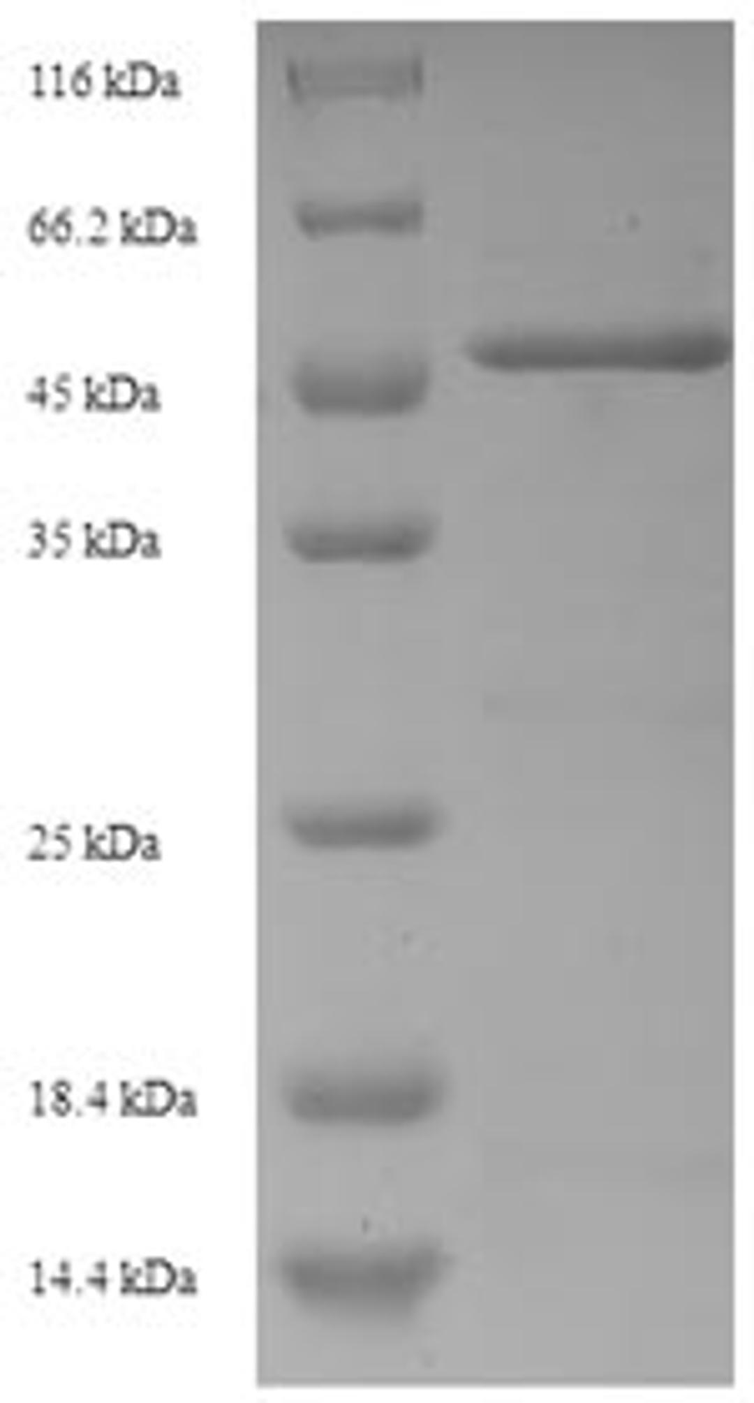 (Tris-Glycine gel) Discontinuous SDS-PAGE (reduced) with 5% enrichment gel and 15% separation gel.
