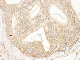 Detection of human MEK2 by immunohistochemistry.