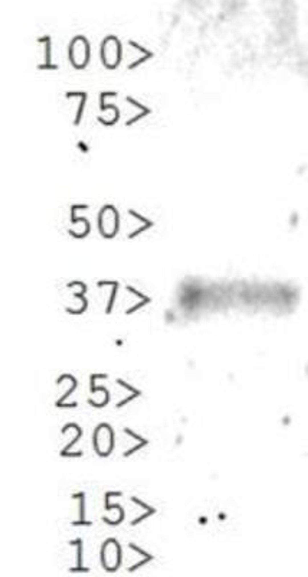 Western Blot: Gli1 Antibody [NBP1-78259] - WB analysis of Gli1 on partial recombinant Gli1 protein (molecular weight of partial recombinant protein is 37 kDa).