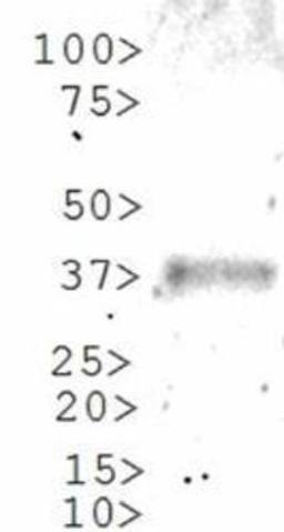 Western Blot: Gli1 Antibody [NBP1-78259] - WB analysis of Gli1 on partial recombinant Gli1 protein (molecular weight of partial recombinant protein is 37 kDa).