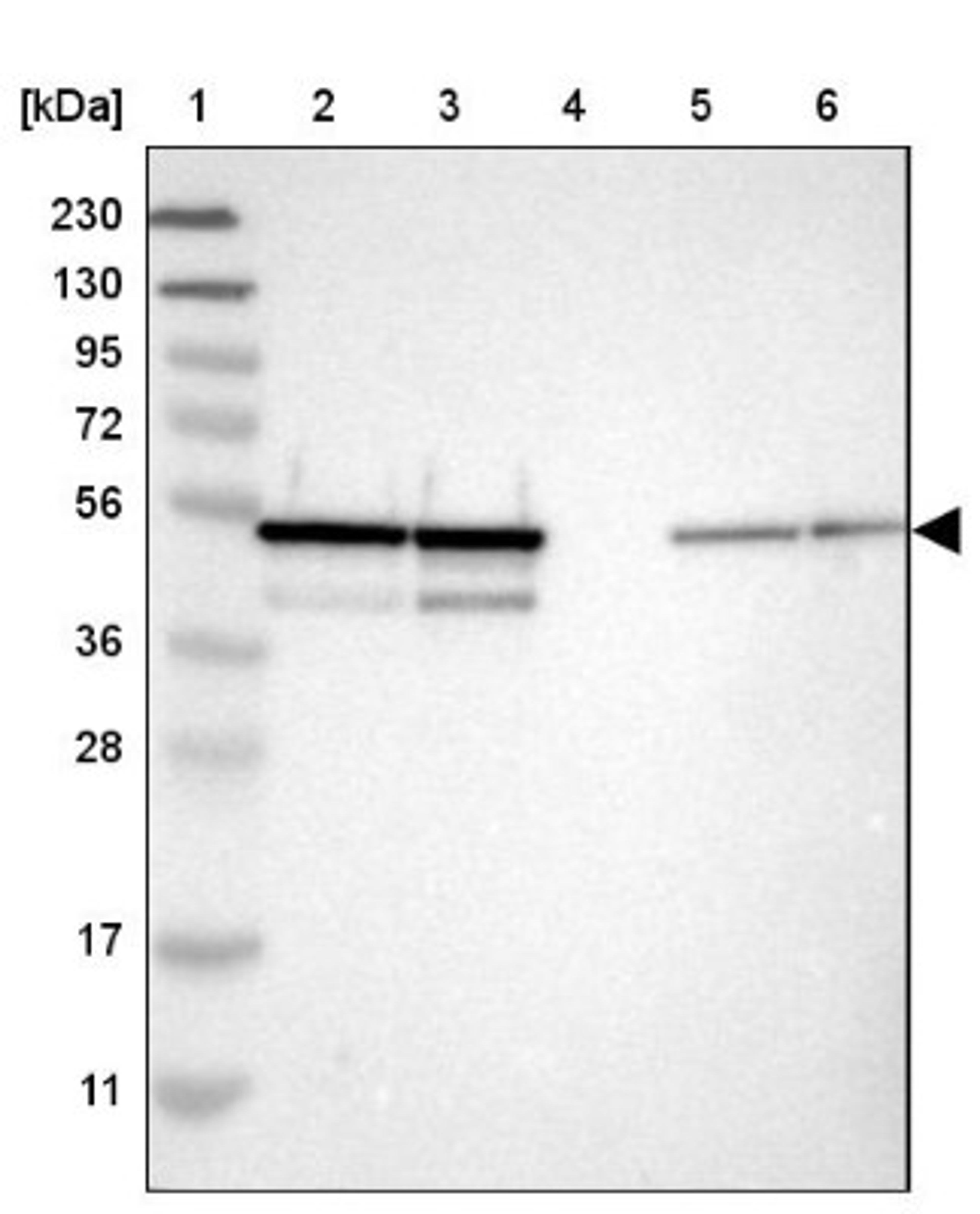 Western Blot: NUDCD3 Antibody [NBP1-82939] - Lane 1: Marker [kDa] 230, 130, 95, 72, 56, 36, 28, 17, 11<br/>Lane 2: Human cell line RT-4<br/>Lane 3: Human cell line U-251MG sp<br/>Lane 4: Human plasma (IgG/HSA depleted)<br/>Lane 5: Human liver tissue<br/>Lane 6: Human tonsil tissue