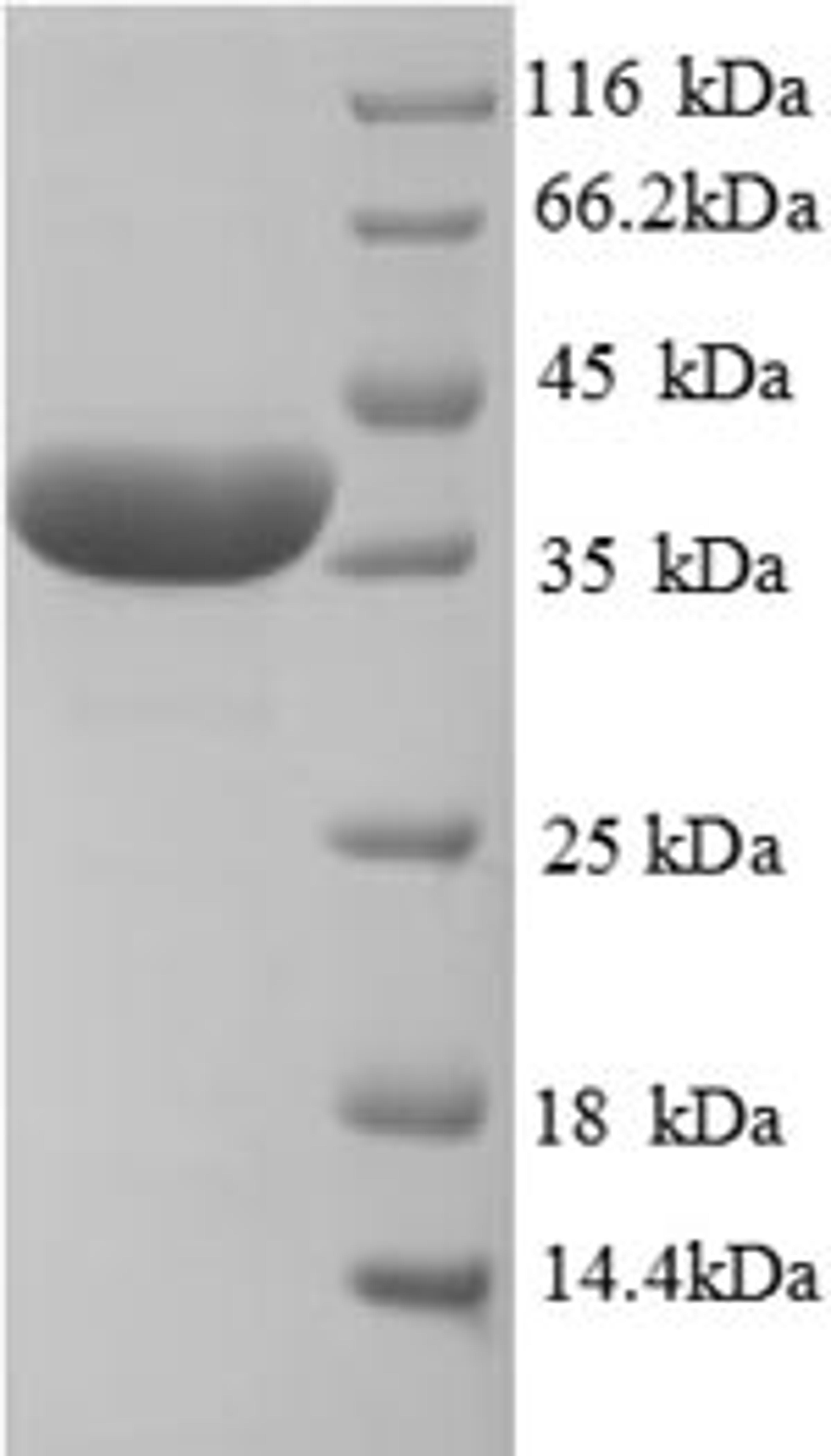 (Tris-Glycine gel) Discontinuous SDS-PAGE (reduced) with 5% enrichment gel and 15% separation gel.