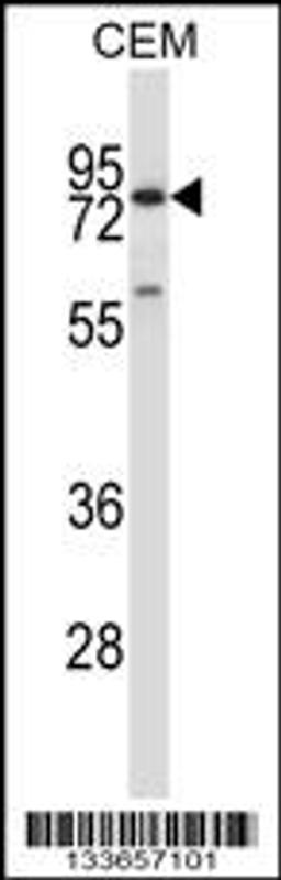 Western blot analysis in CEM cell line lysates (35ug/lane).