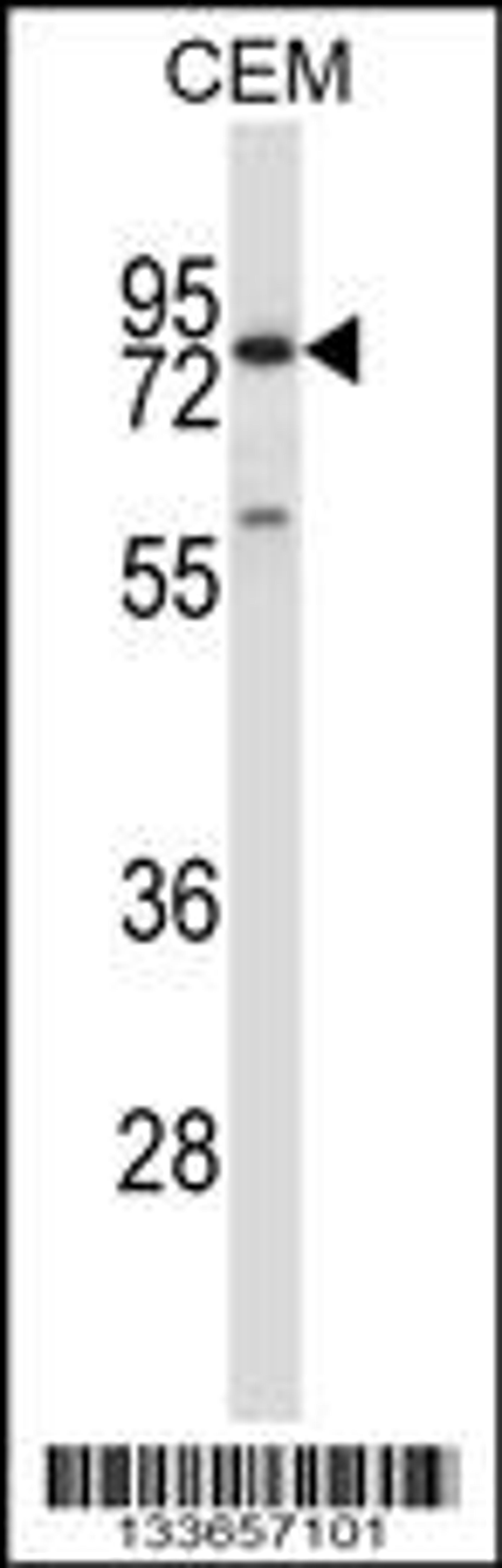 Western blot analysis in CEM cell line lysates (35ug/lane).