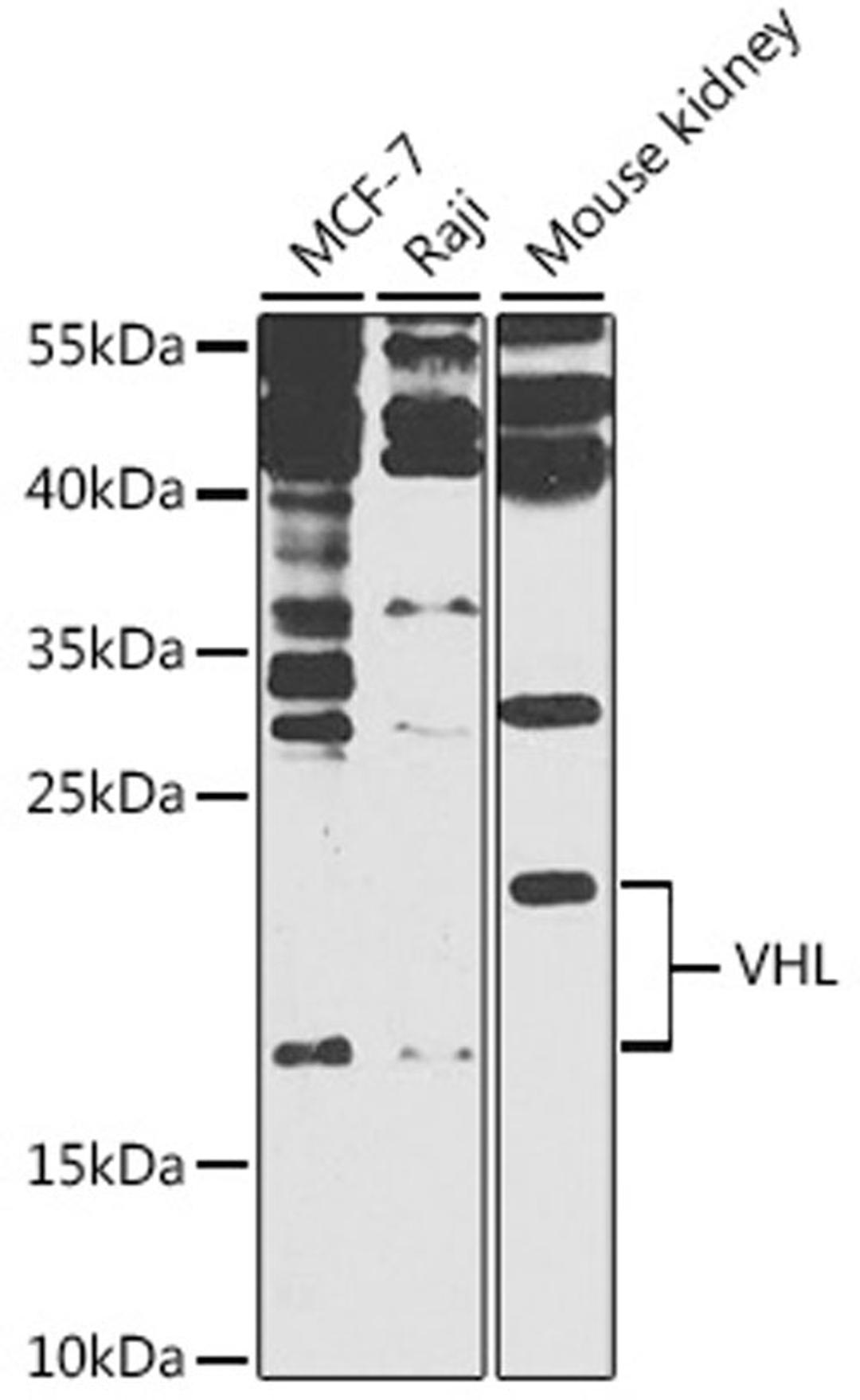 Western blot - VHL antibody (A11240)