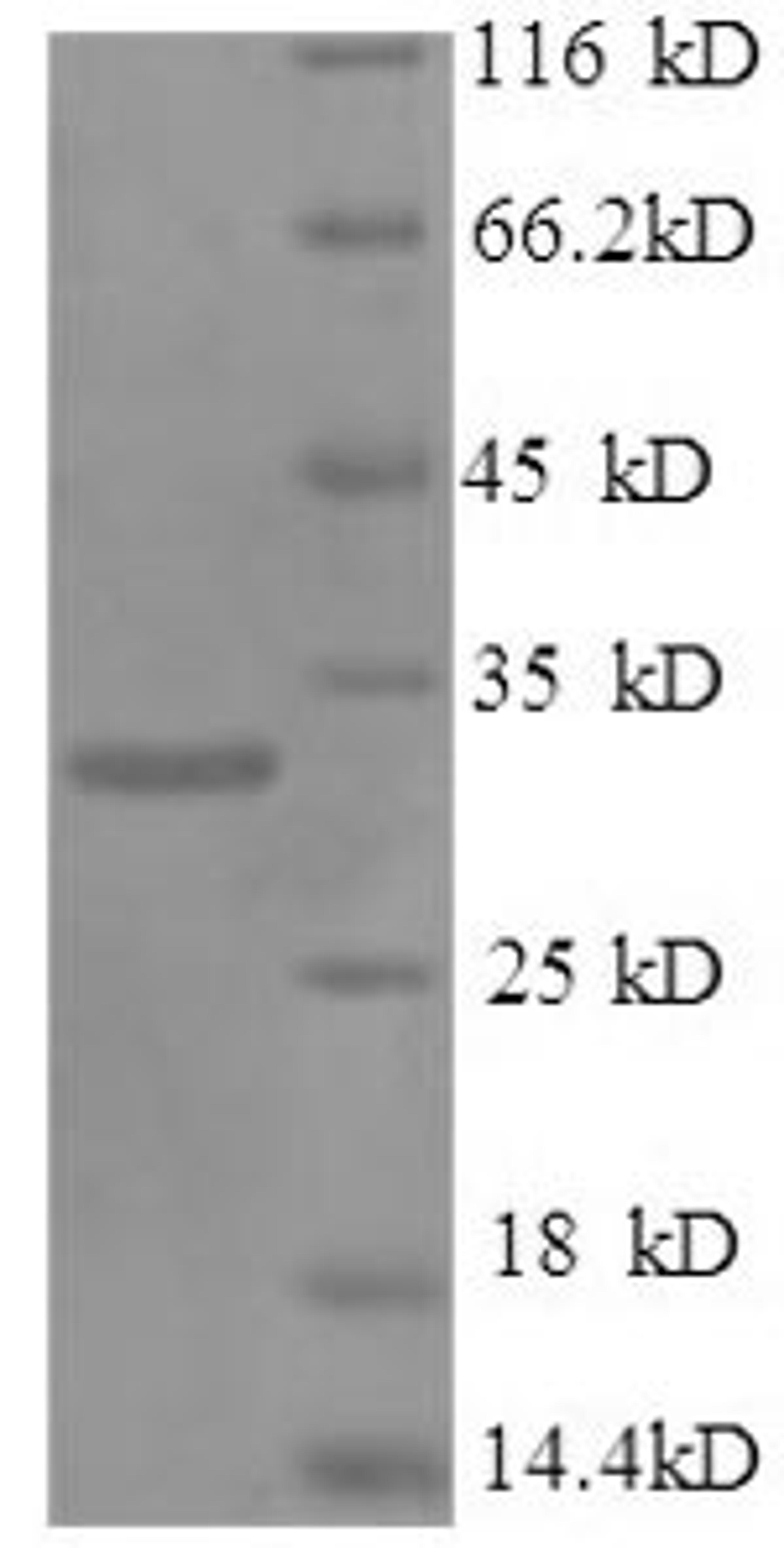 (Tris-Glycine gel) Discontinuous SDS-PAGE (reduced) with 5% enrichment gel and 15% separation gel.