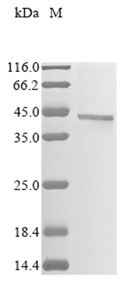 (Tris-Glycine gel) Discontinuous SDS-PAGE (reduced) with 5% enrichment gel and 15% separation gel.