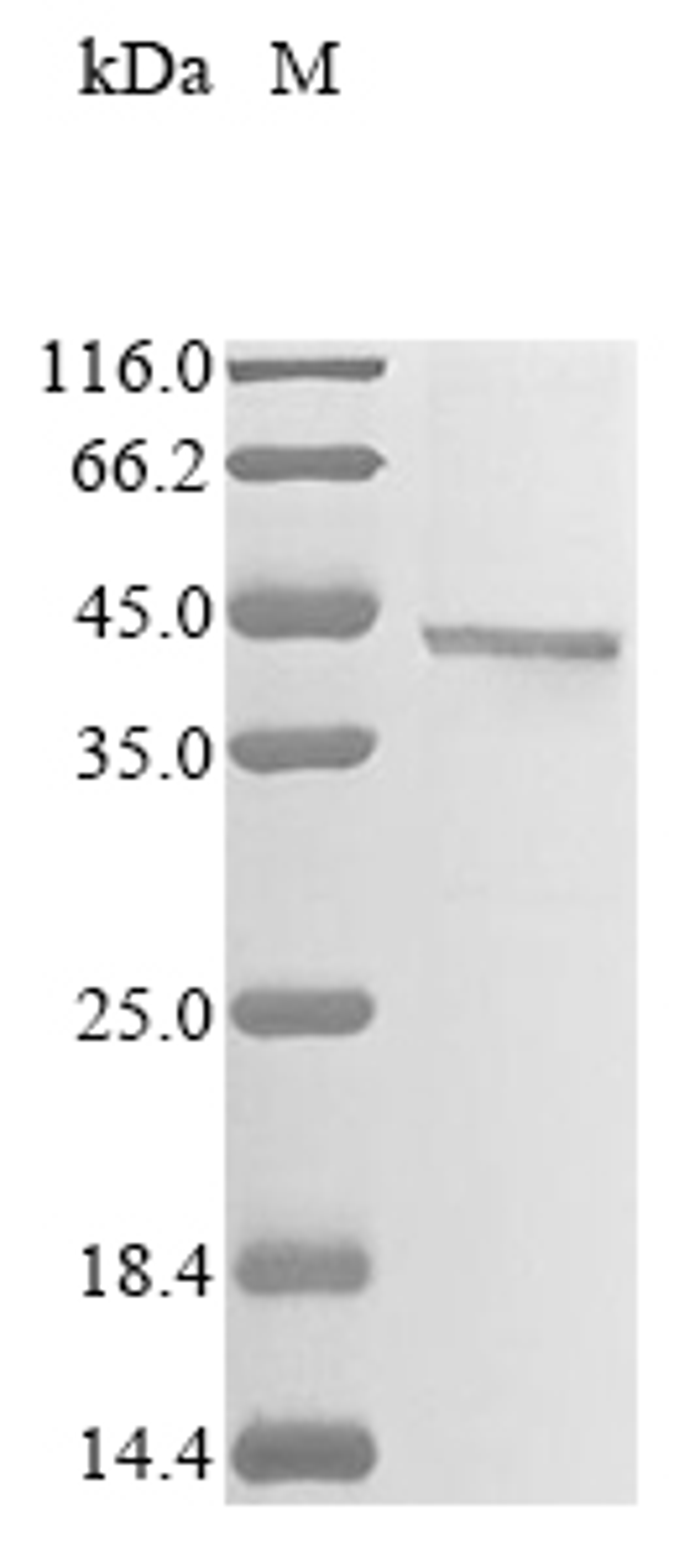 (Tris-Glycine gel) Discontinuous SDS-PAGE (reduced) with 5% enrichment gel and 15% separation gel.