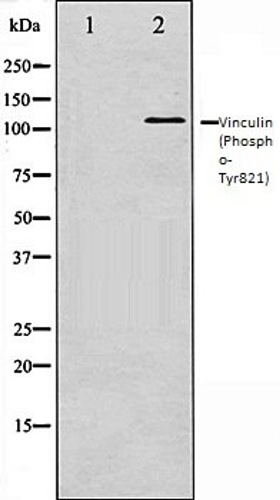 Western blot analysis of HeLa whole cell lysates using Vinculin (Phospho-Tyr821) antibody, The lane on the left is treated with the antigen-specific peptide.