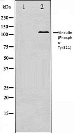 Western blot analysis of HeLa whole cell lysates using Vinculin (Phospho-Tyr821) antibody, The lane on the left is treated with the antigen-specific peptide.