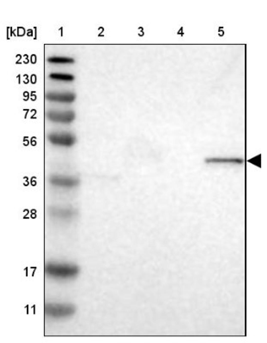 Immunohistochemistry: BTN3A1 Antibody [NBP1-90750] - Lane 1: Marker [kDa] 230, 130, 95, 72, 56, 36, 28, 17, 11<br/>Lane 2: Human cell line RT-4<br/>Lane 3: Human cell line U-251MG sp<br/>Lane 4: Human plasma (IgG/HSA depleted)<br/>Lane 5: Human liver tissue